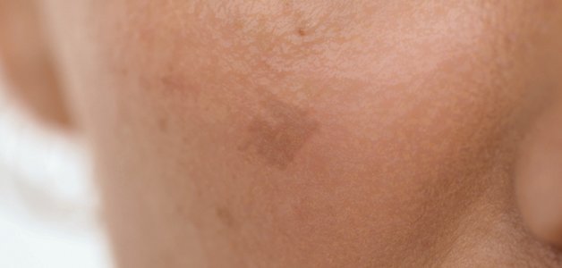 michelle_avant_01_serum_b3