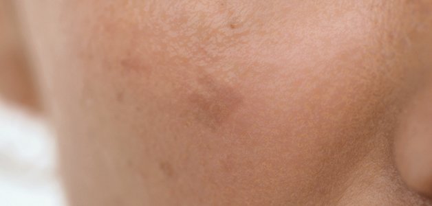 29-michelle_apres_01_serum_b3